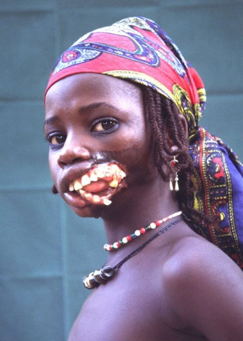 Xem ngay 30 hình ảnh cô gái xấu xí cực sốc cho người xem